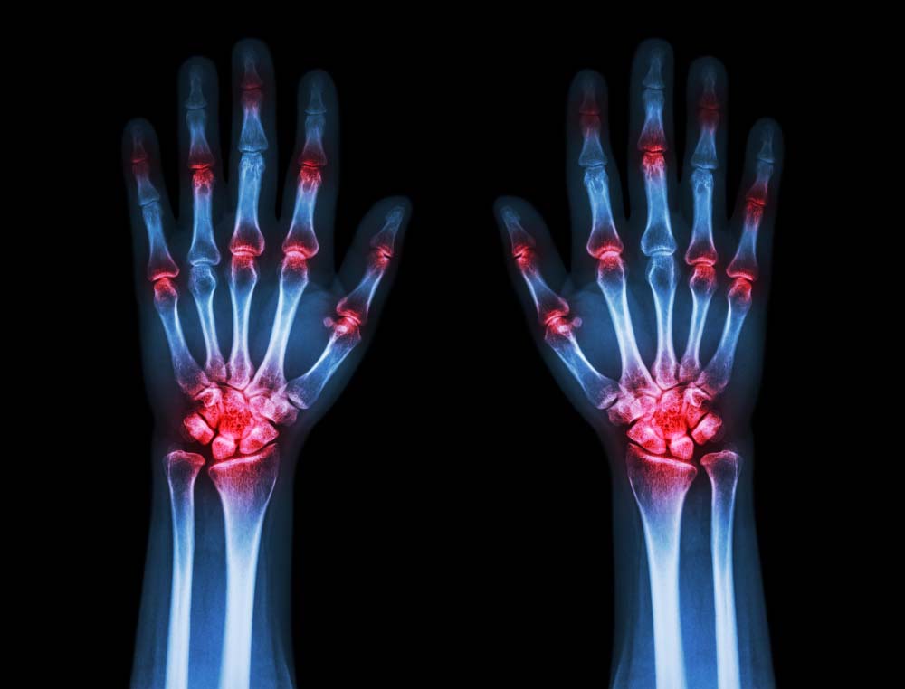 Лечение болей в пальцах рук