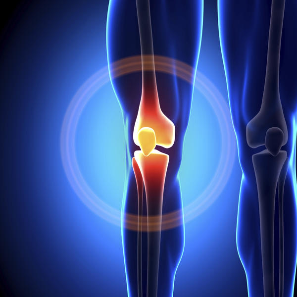 Почему щелкает колено и в каких случаях это опасно