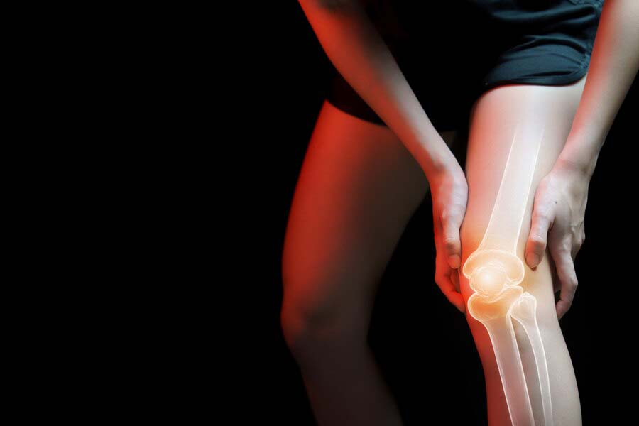 Степени гонартроза коленного сустава