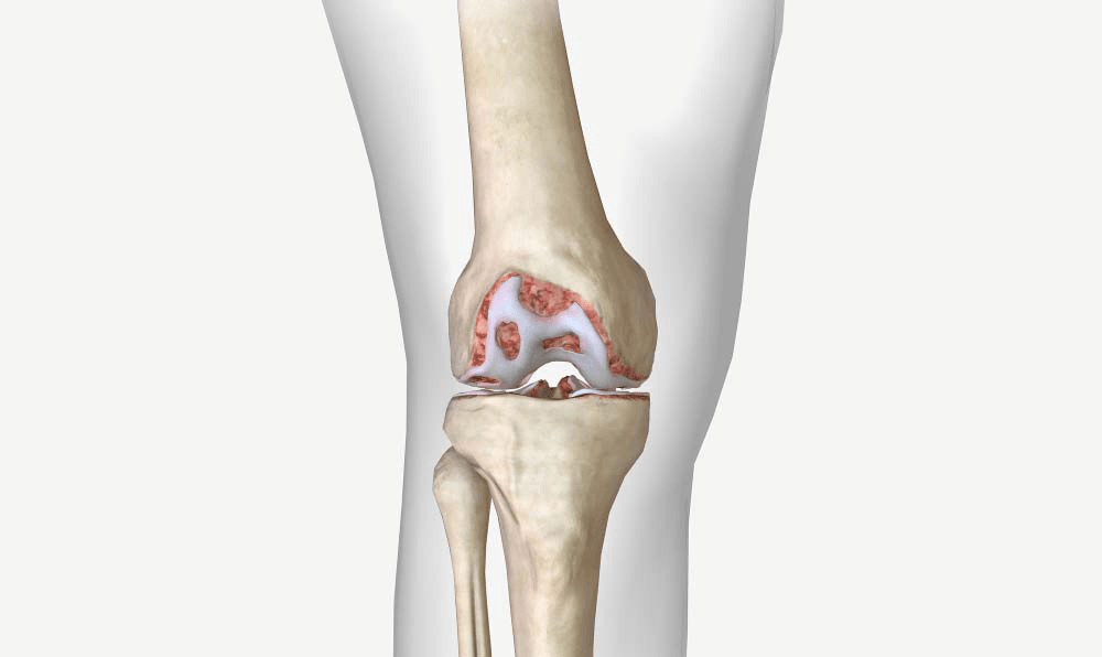 Болят мышцы колена