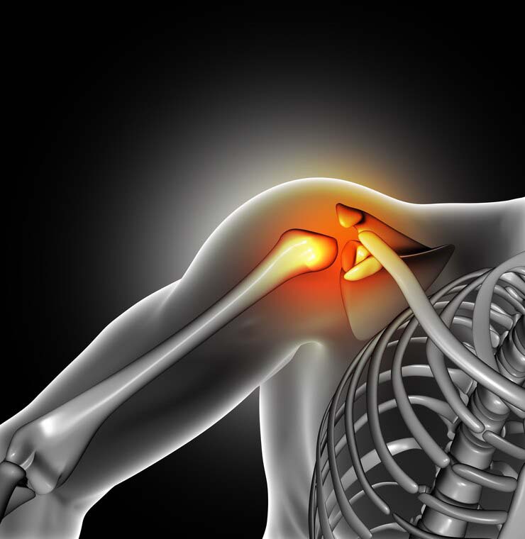 Профилактические меры при болях в спине справа и лопатке