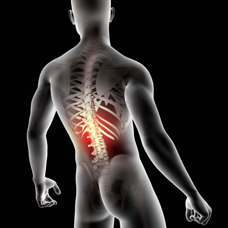 Причины отдающих болей в спине и ребрах