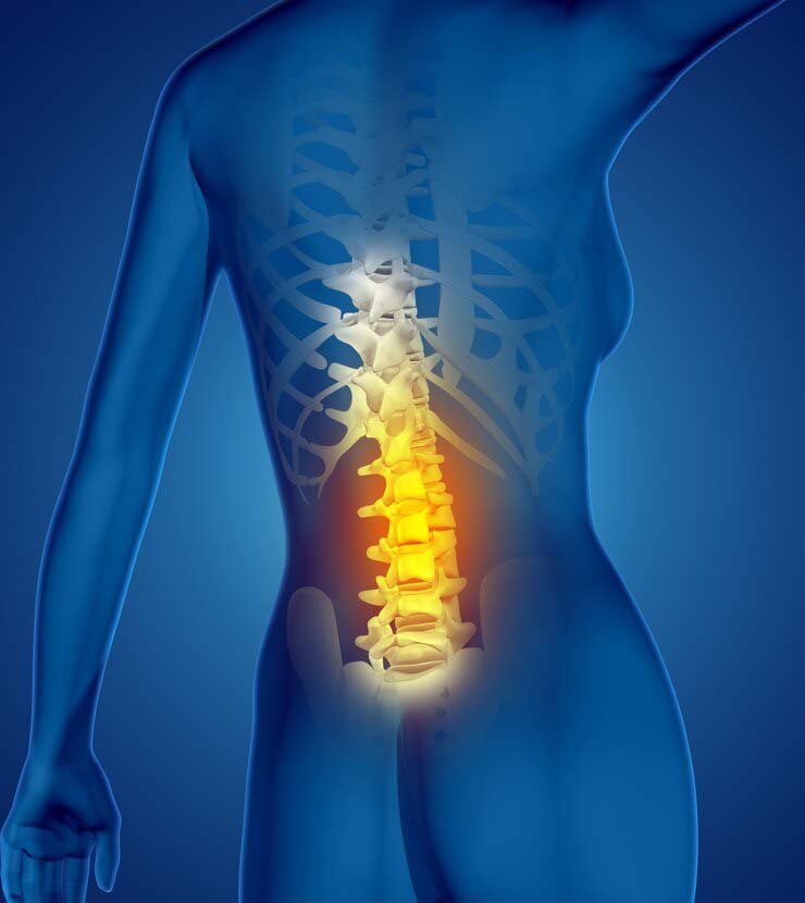 Почему появляются боли в спине?